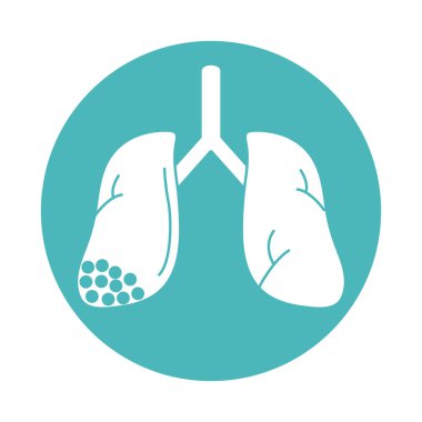 Virüs covid 19 salgın akciğerler insan hastalıkları blok biçim simgesi