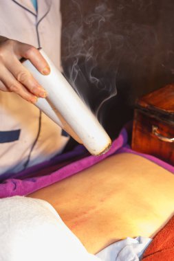 Moxibustion