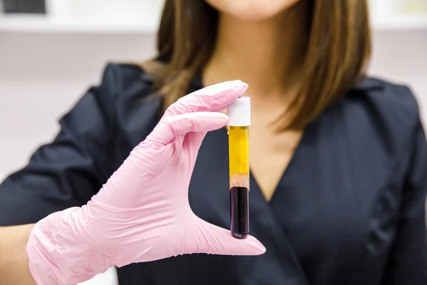 Enjeksiyon için kan, plazma ve vitaminle test tüpü tutan güzel bir güzellik uzmanı.