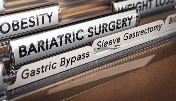 Ilustrace Složky Zaměřením Záložky Texty Bariatrická Chirurgie Žaludeční Bypass Rukáv — Stock fotografie