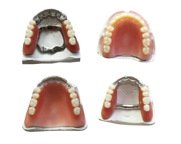 Mandíbulas Dentárias Para Trabalho Dentista Fundo Branco — Fotografia de Stock