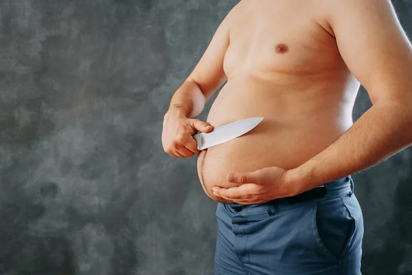 重量の損失、肥満、ダイエット、整形手術、脂肪吸引 c — ストック写真