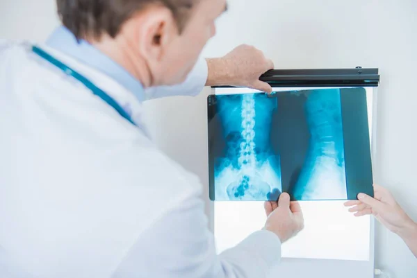 Röntgenbilder Arzt Diagnose — Stockfoto