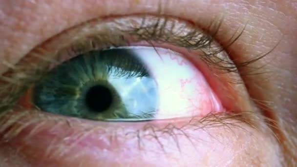 Het breidt Human Eye Iris uit. Blanke man in de 30. — Stockvideo