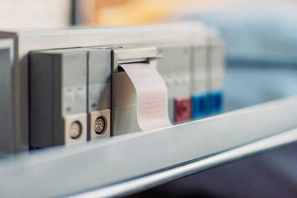 electrocardiogram tracing with ribbon