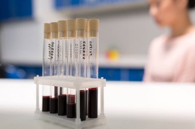 tüplerini kan testi örnekleri