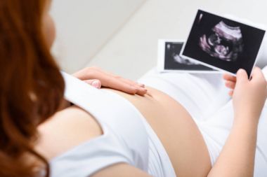 pregnant woman with ultrasound scans