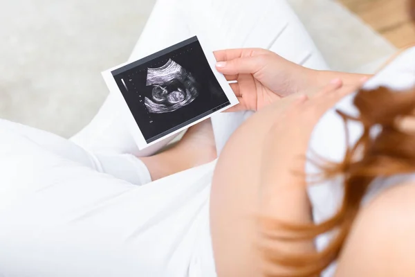 Mujer embarazada con ecografía — Foto de Stock