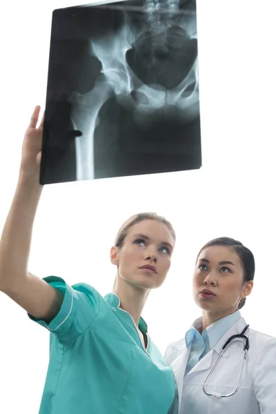 Médicos olhando para a imagem de raio-x juntos — Fotografia de Stock