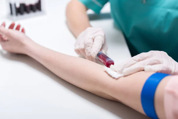 Медсестра берет образец крови со шприцем — стоковое фото