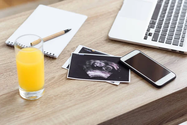 Ultrasound scan and gadgets on table — Stock Photo