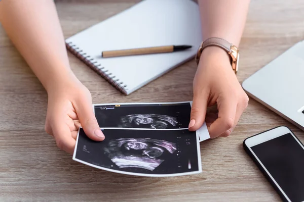 Woman holding ultrasound scan — Stock Photo
