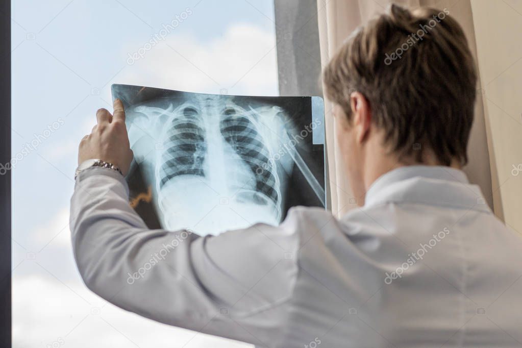 doctor holding X-ray