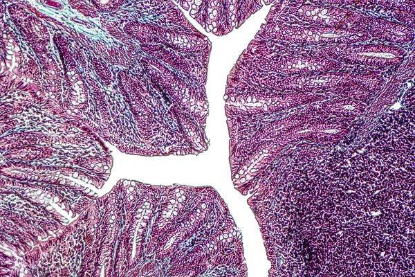 Intestino grueso de una rata — Foto de Stock