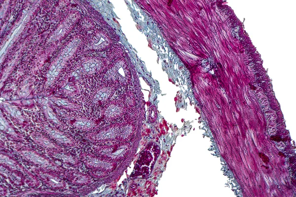 Large intestine of a rat — Stock Photo, Image