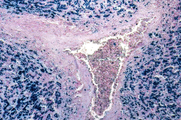 Insan karaciğer micrography — Stok fotoğraf