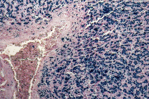 Insan karaciğer micrography — Stok fotoğraf