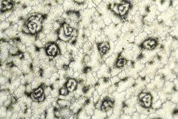 Структура клеток бриофилла — стоковое фото