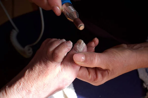 Curatieve nagel behandelingen op veroudering vrouwen nagels — Stockfoto