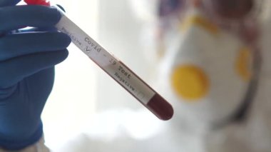 Doktorlar, Coronavirus Covid-19 'un hızla yayılması için üzerinde kan örneği olan bir test tüpünü tutuyorlar. Pozitif test