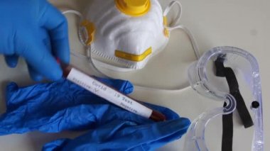 Masadaki yakın plan tıbbi koruyucu maskeler ve mavi eldivenler. Doktorlar masaya bir eldiven koyuyorlar. Pozitif test koronovirüs covid-19 içeren bir test tüpü.
