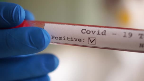 Close-up van een reageerbuis met een bloedplasma monster. Positieve test coronovirus covid-19. Testbuis in handen in medische handschoenen — Stockvideo