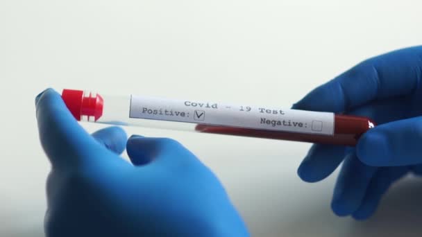 一个微生物学家手里拿着Coronovirus covid-19的阳性检测。血浆试管，结肠癌病毒实验室试验 — 图库视频影像