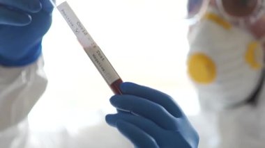 Koruyucu giysi ve eldiven giymiş bulaşıcı bir hastalık doktorunun ellerinde plazma olan test tüpü. Coronovirüs covid-19 için pozitif test