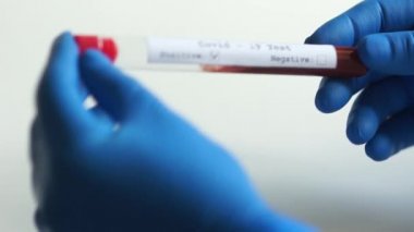 Kan plazma örneğiyle test tüpü, laboratuvar test koronovirüsü. Bir mikrobiyologun ellerinde Coronovirus covid-19 testi pozitif.