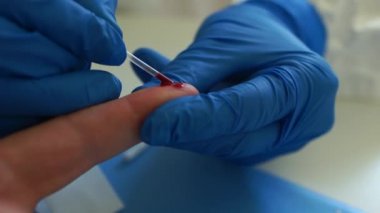 Coronovirüs covid-19 analizi için kan örneği alıyoruz. SARS-CoV-2 virüsünün belirlenmesi için test kaseti. Hızlı test covid 19. Serolojik kan testi