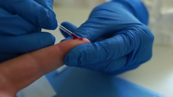 Zbliżenie próbki krwi do analizy koronowirusa covid-19. Kaseta testowa do oznaczania wirusa SARS-CoV-2. Szybki test covid 19. Badanie serologiczne krwi — Wideo stockowe