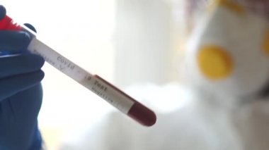 Koruyucu kıyafetli ve elinde deney tüpüyle maskeli bir mikrobiyolog portresi. Coronovirüs covid-19 için pozitif test