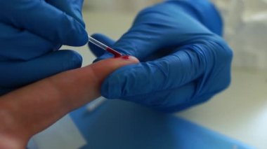 Hızlı test covid 19. Serolojik kan testi. Coronovirüs covid-19 analizi için kan örneği alıyoruz. SARS-CoV-2 virüsünün tespiti için test kaseti