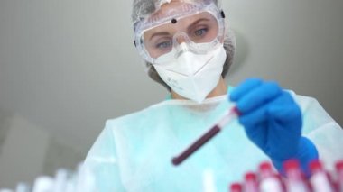 Laboratuvardaki güzel kız laboratuvar asistanı üzerinde Coronovirus Covid-19 enfeksiyonu olan bir kan örneği olan bir test tüpü tutuyor. Tanı Bilgisi Sars-CoV-2