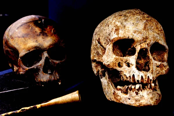 Iki insan kafatası ve eski cerrahi aletler — Stok fotoğraf
