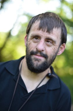 Down sendromu adam portresi