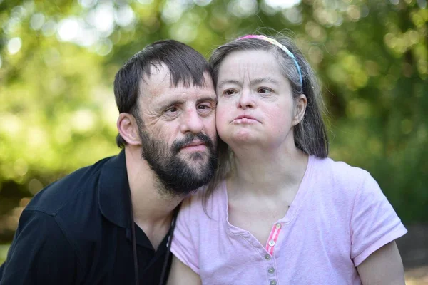 Love couple with down syndrome — Stock Photo, Image