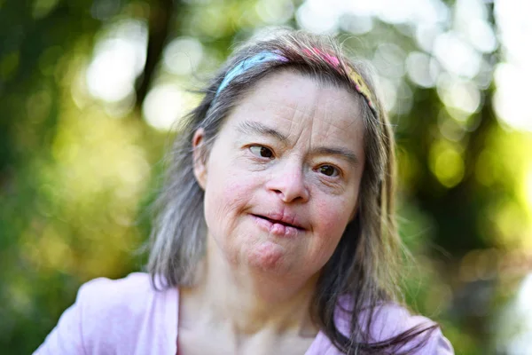 Woman with down syndrome — Stock Photo, Image