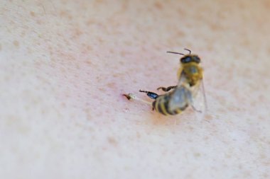 Böceğe yakın, seçici odaklanma