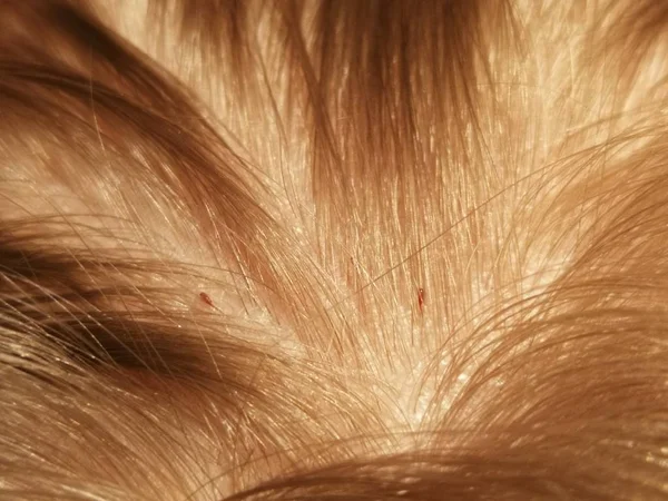 Close Louses Human Hair — Foto Stock