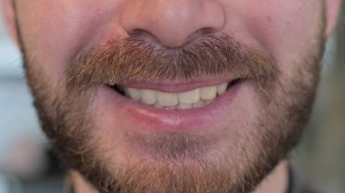 Sağlıklı Dişleriyle Gülümseyen Beyaz Adam 'a Yaklaş