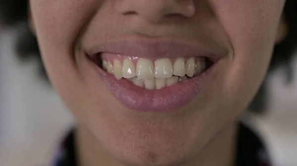 The Close of African American Woman Teeth and Smiling — Stok Foto