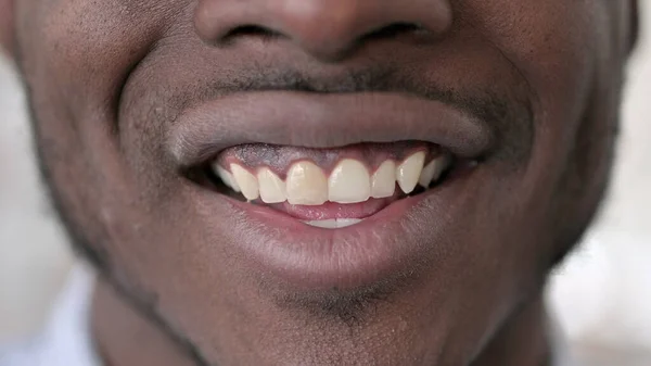 Primer plano de Boca de sonriente hombre africano —  Fotos de Stock