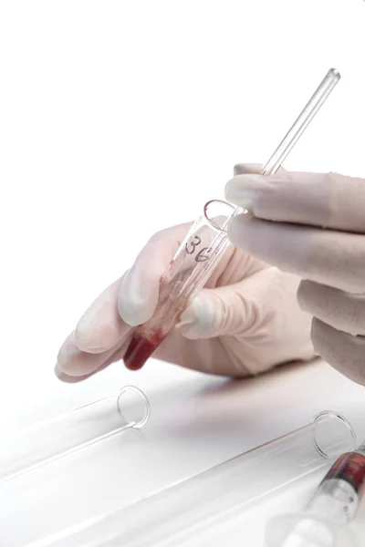 La mano enguantada de un asistente de laboratorio sostiene un tubo de ensayo con una muestra de sangre sobre un fondo blanco. también en la foto hay una jeringa con una muestra de sangre — Foto de Stock