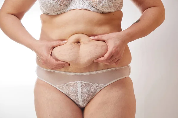Una Mujer Con Sobrepeso Años Muestra Pliegues Grasa Estómago Sobre — Foto de Stock