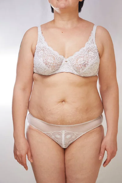 一位40岁的女人 穿着内衣 胸部凹陷 体重超标 有伸展痕迹 背景呈白色孤立 医学和化妆品学的概念 — 图库照片