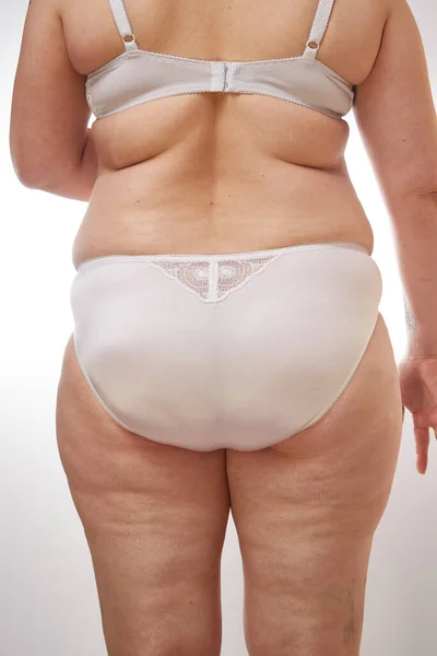 Piernas Nalgas Espalda Una Mujer Años Con Estrías Celulitis Exceso — Foto de Stock