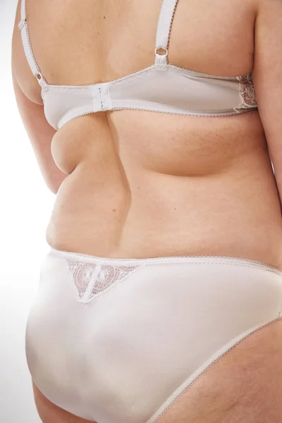 Piernas Nalgas Espalda Una Mujer Años Con Estrías Celulitis Exceso — Foto de Stock