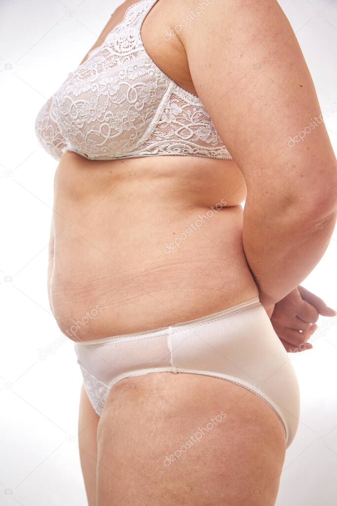 legs and belly of a 40-year-old woman with stretch marks, cellulite and excess weight on a white isolated background