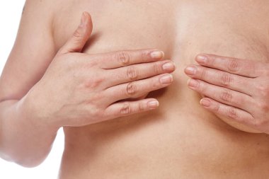 40 yaşında şişman bir kadın sarkık göğüslerini beyaz bir arka planla kapatıyor. Tıp ve kozmetoloji kavramı